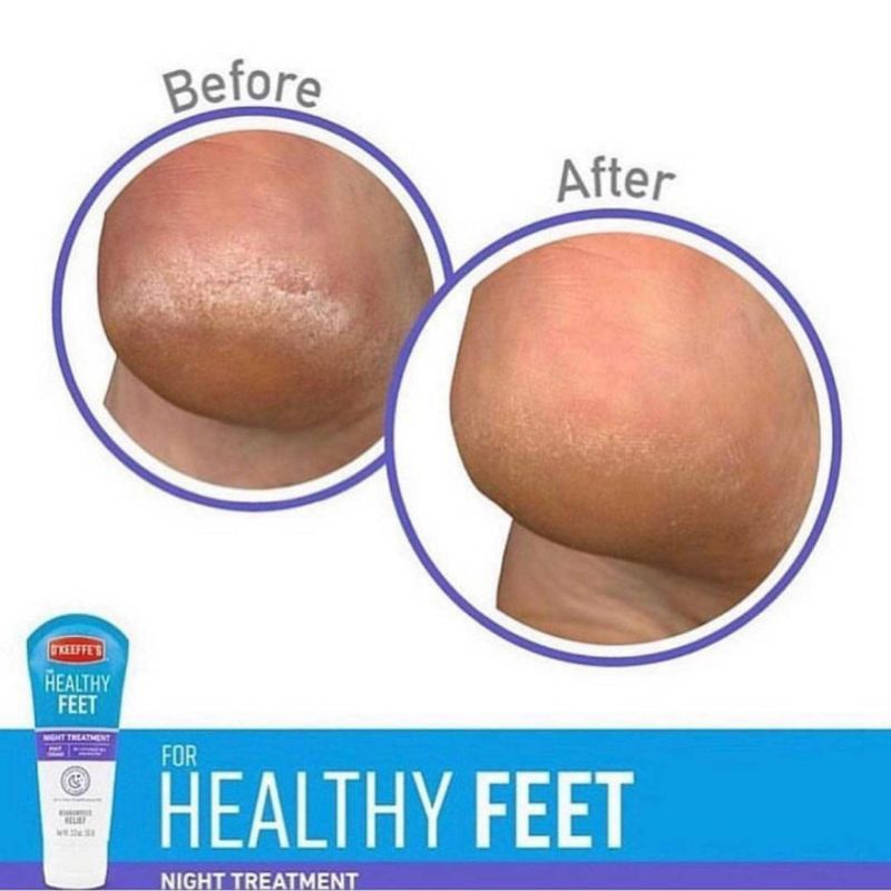 ครีมทาเท้า / ครีมทามือ O’Keeffe’s Cream นำเข้าจากอเมริกา