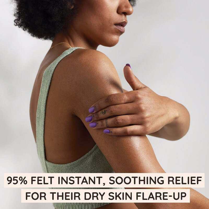 NEW!! Aveeno Eczema Therapy, Rescue Relief Treatment Gel Cream, ขนาด 150 มล.